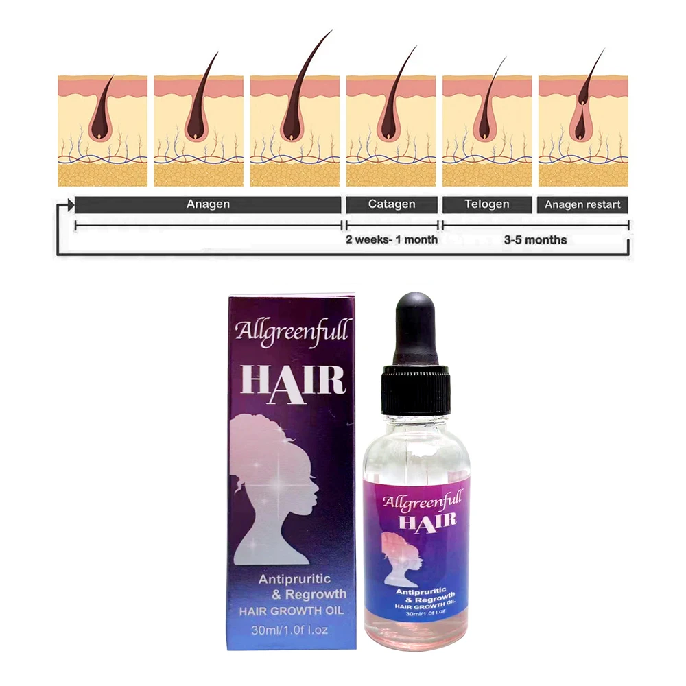 Free Sample Wholesale Nourishing Scalp Hair Care Loss Treatment Hair Growth Oil Serum