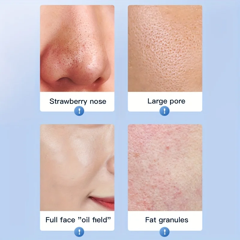 Professional Ultrasonic Skin Scrubber For Face