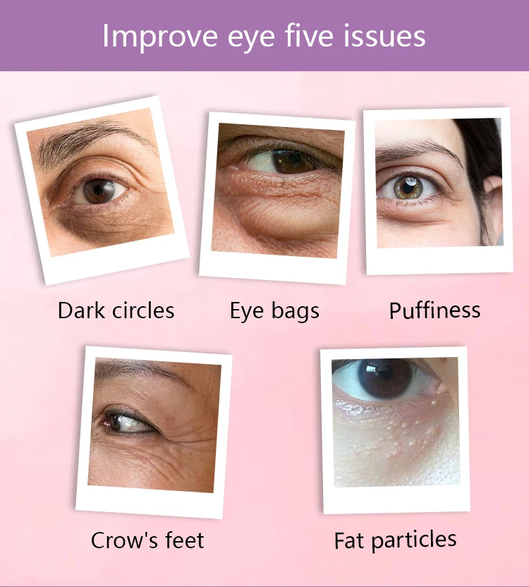 Anti-Wrinkle Eye Cream To Remove Dark Circles Nicotinamide Firming Vitality Eye Cream Under Eye Bag Puffy Fat Removal