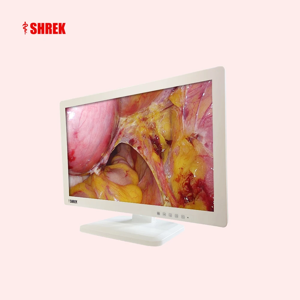 High Color Sensor Medical endoscopy camera