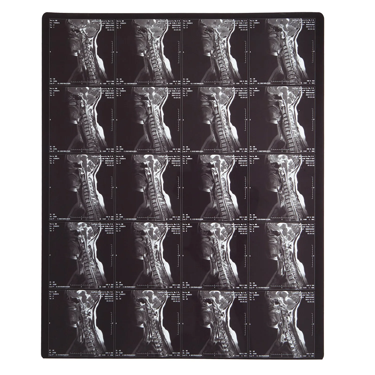 
20x25 cm inkjet medical x-ray film for CT, CR, MRI of hospitals 