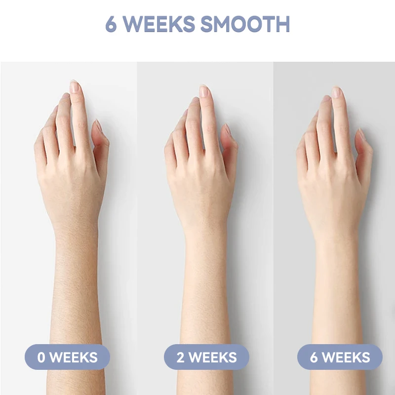 Wholesale china supplier ice feel hair removal home use smooth skin painless IPL hair removal permanent