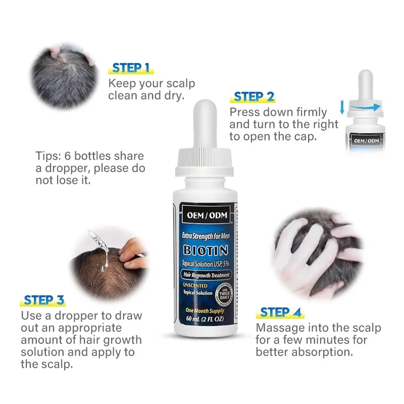 OEM ODM 2% 5%Hair Regrowth Treatment Serum Prevents Hair Loss Hair Growth Oil For Men And Women