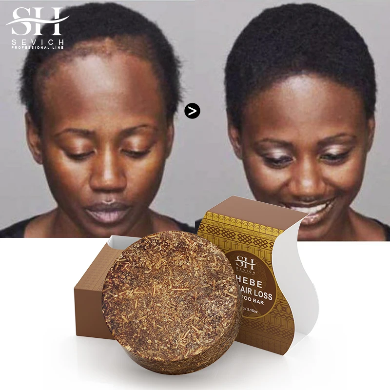 Africa Chad Chebe Shampoo Bar Natural Hair Growth Soap Women Fluffy Anti Loss Hair Regrowth Soap Treatment Hair Care Product