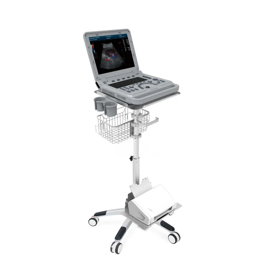 CONTEC CMS1700A hot sale medical Color Doppler cardiac ultrasound scanner