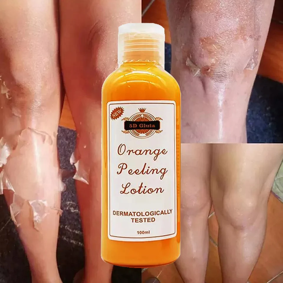Custom Remove Dead Skin Exfoliating Face Orange Body Lotion Peeling for Lightening Whitening Exfoliating
