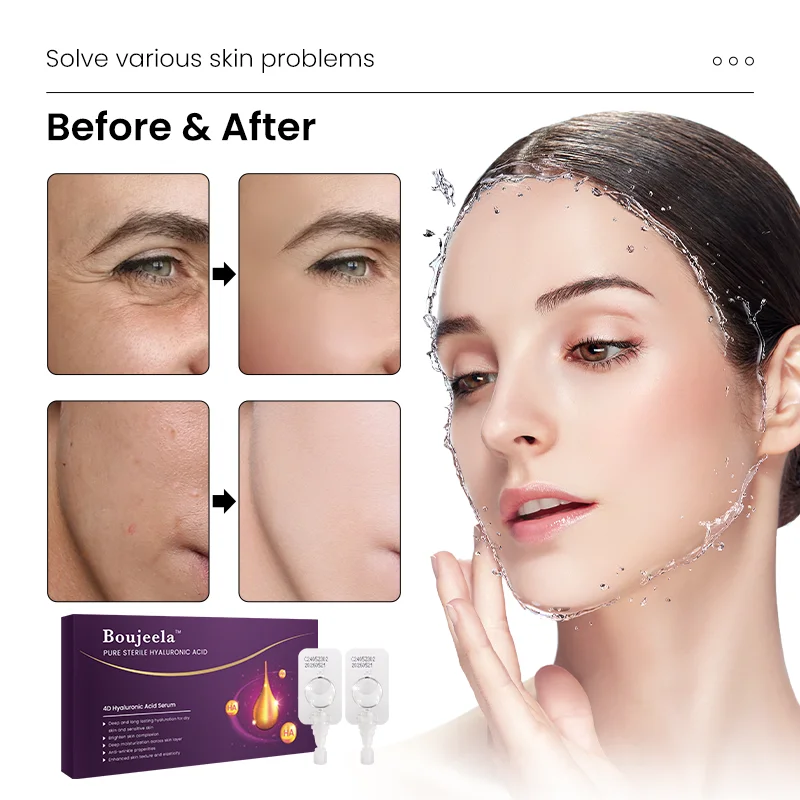 Most Popular Hyaluronate Acid 1ml*10vials Volume Disposable Ampoule Portable Anti Aging Face Serum