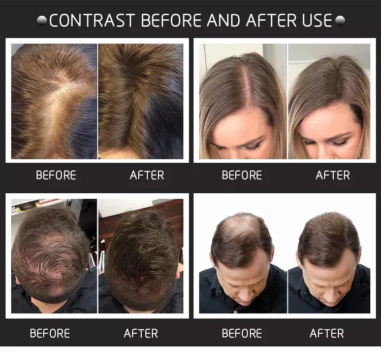 hair fiber (10).jpg