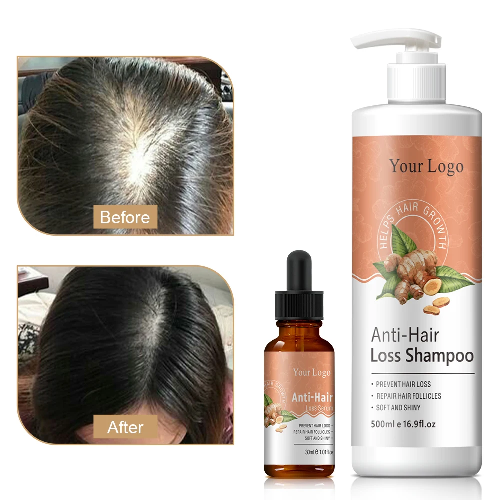 Custom Logo Hair Loss Shampoo Repairing Treatment Fast Anti Loss Hair Growth Shampoo