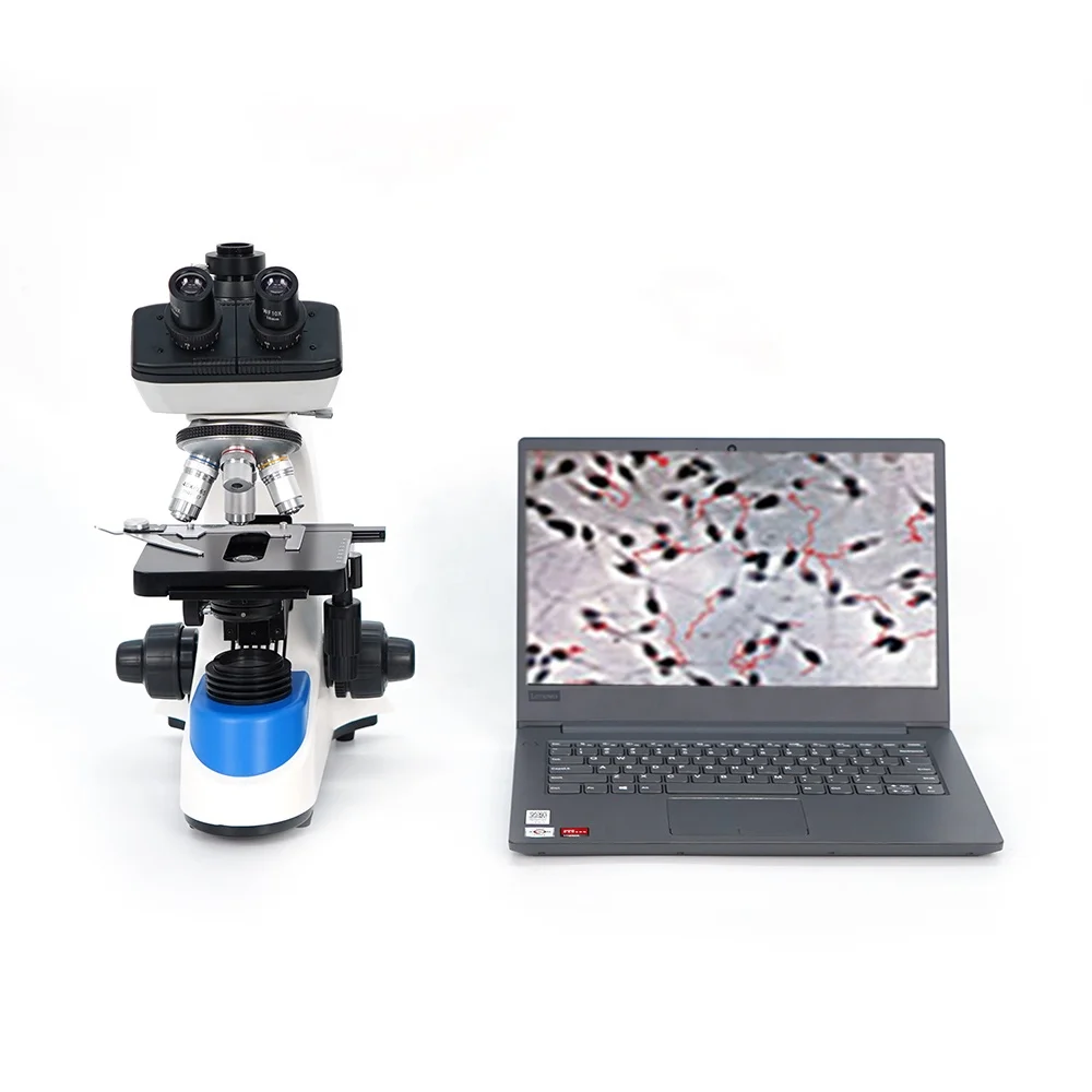 Vet Animal Cow Sperm Analyzer Count Microscope Portable Automated Dog Cattle Veterinary Semen Analyzer