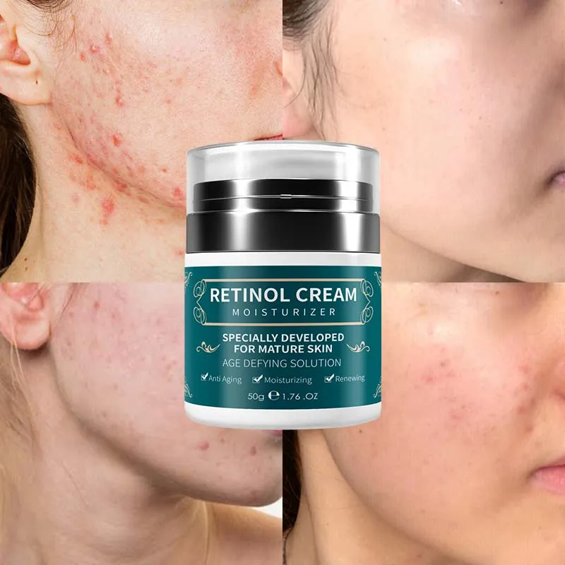 Callogen Retinol Moisturizer Face Body Cream Vitamin E Hyalronic Acid Moisturizing Retinol Firming Cream for Face