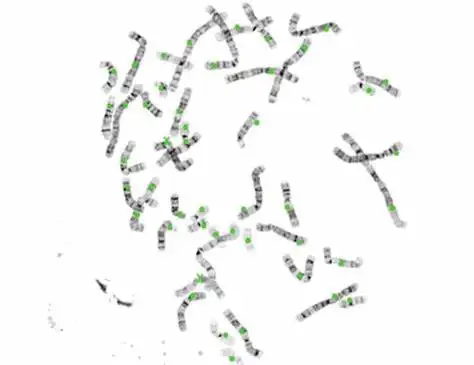  SH Chromosome Авто кариотипирование образ