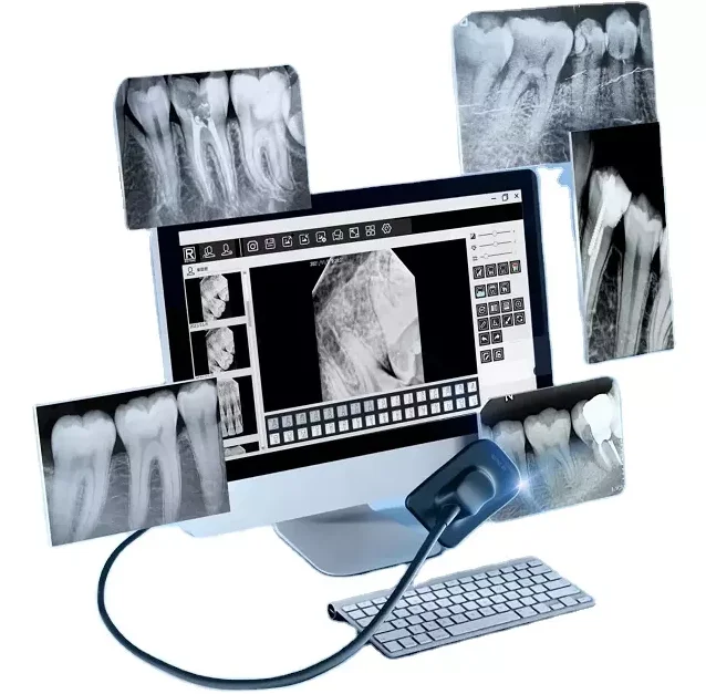 MDC63 Durable robust cable connection Dental rvg x ray sensor price discounted for big promotion