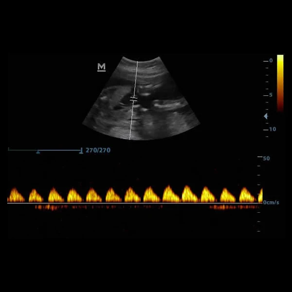 Portable Medical ultrasound instruments Human use Mindray DP10  Black and White  ultrasound machine price  veterinary Scanner