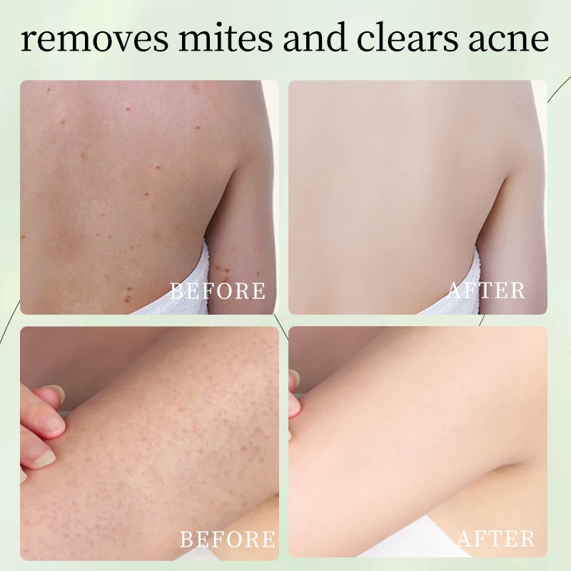 New Arrival Natural Green Shower Gel Customized Logo Acne Removal Multideep-clean Body Wash Wholesale MOOYAM 500ml Shower Gel