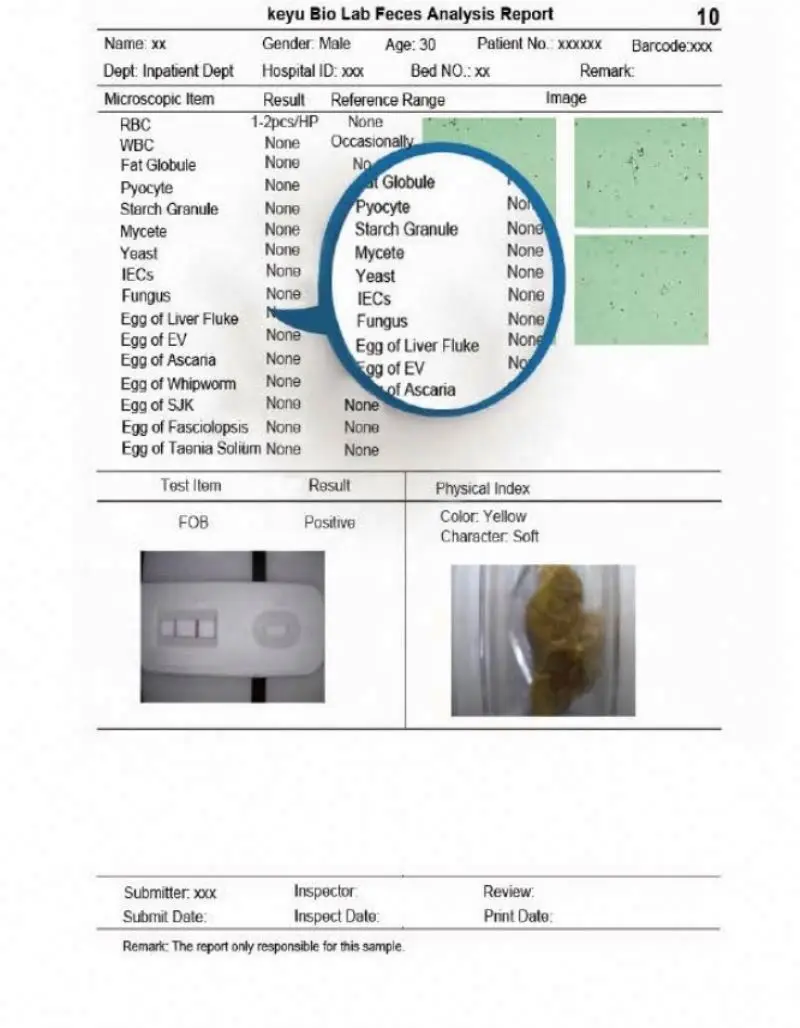 Dual Channel Automated Feces Analyzer/Analyzes of A Jar of Feces
