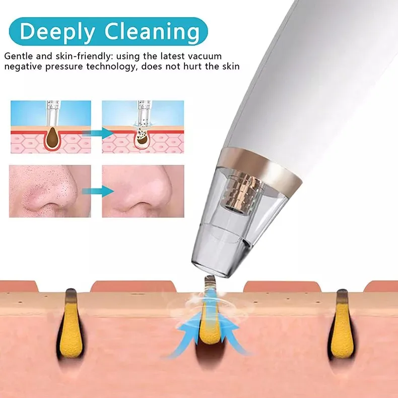 Home Portable Remove Skin Acne Pimple Deep Cleansing Face Care Treatment Products Remover For Sensitive Skin