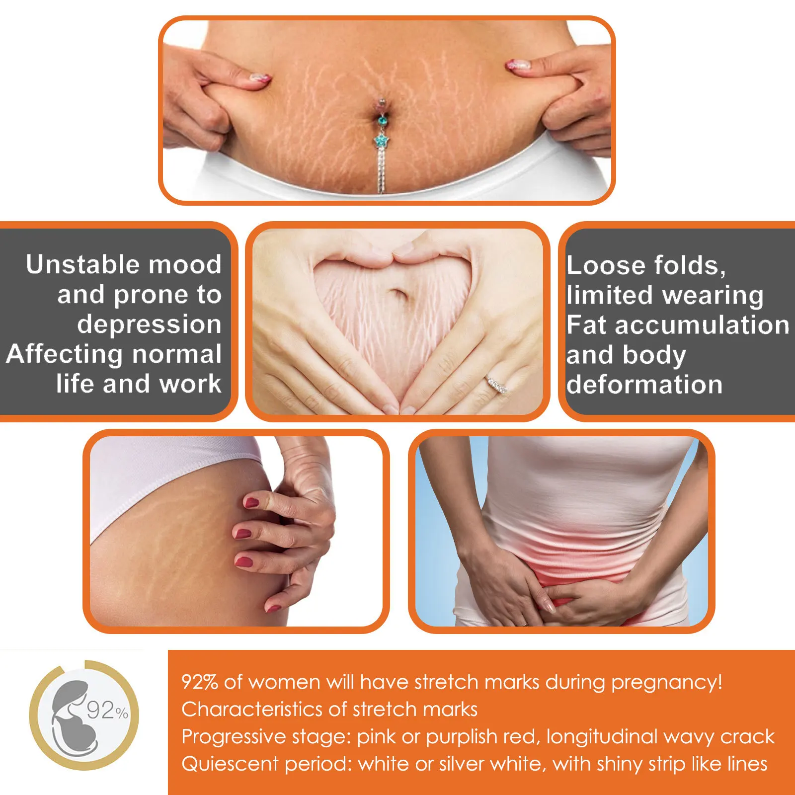 Swift Scar Stretch Mark Relief Hydration Pure Botanical Complexion Revitalizing Vitamin e Body massage Cream