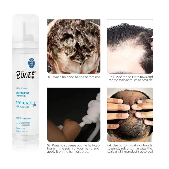 60ml private label Topical solution Collagen biotin bald hair growth oil foam