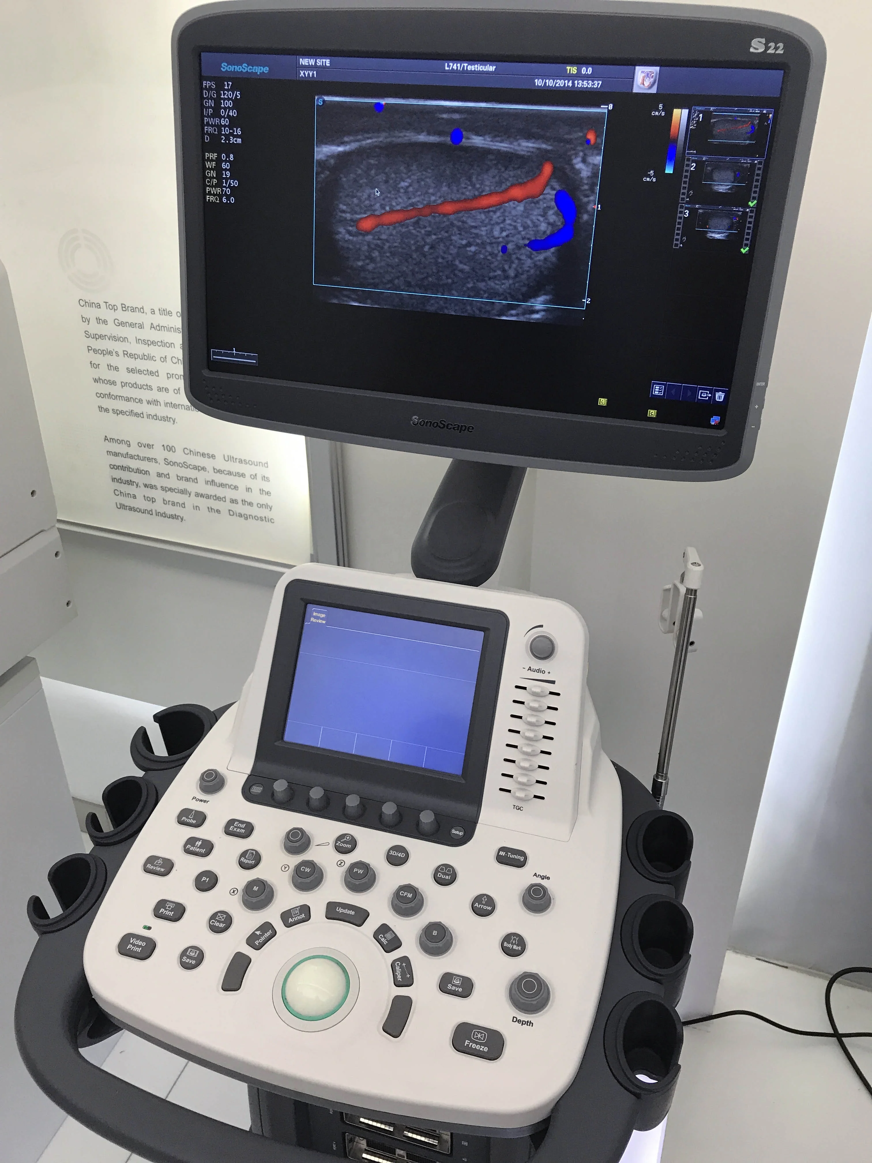 Медицинские ультразвуковые инструменты sonoscape s22 ультразвуковая машина