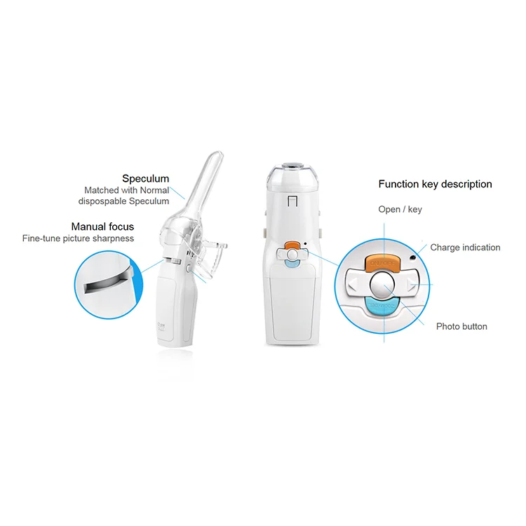 Women Vaginal Diagnose Gynecology Digital Portable Self-exam Mini Usb Handheld Electronic Video Colposcope