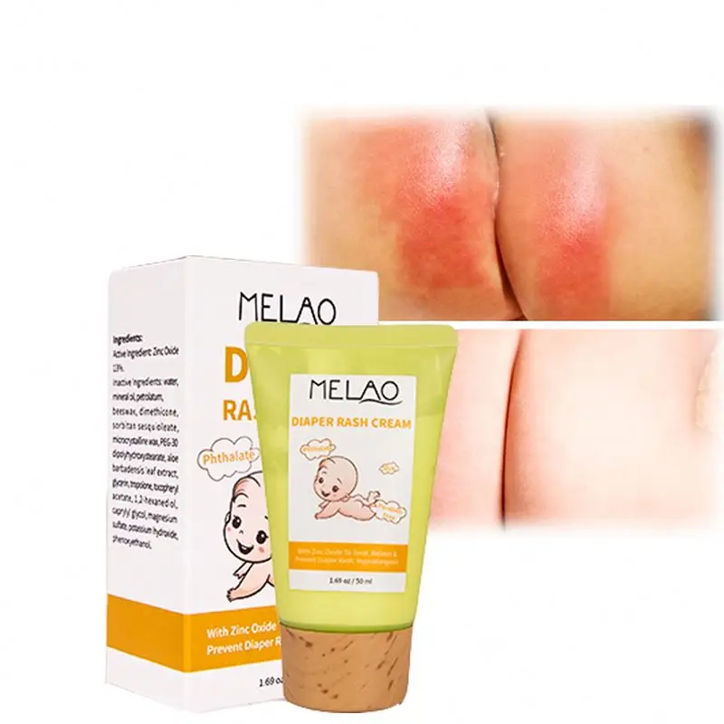 Wholesale Private Label Natural organic diaper rash cream for Moisturizing Smoothing baby skin care