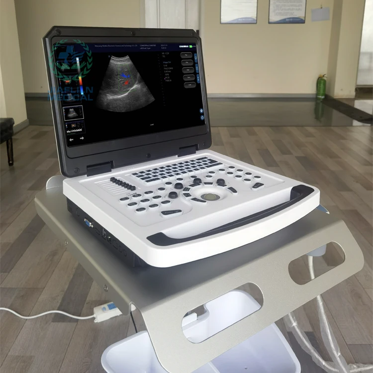 Vet Veterinary Ultrasound Machine Black White Digital Ultrasonic Diagnostic Imaging System for Animal Hospital