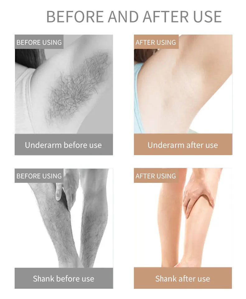 Painless Epilator Facial Armpit Penishair Removal Epilator Shaver Epilator for Man