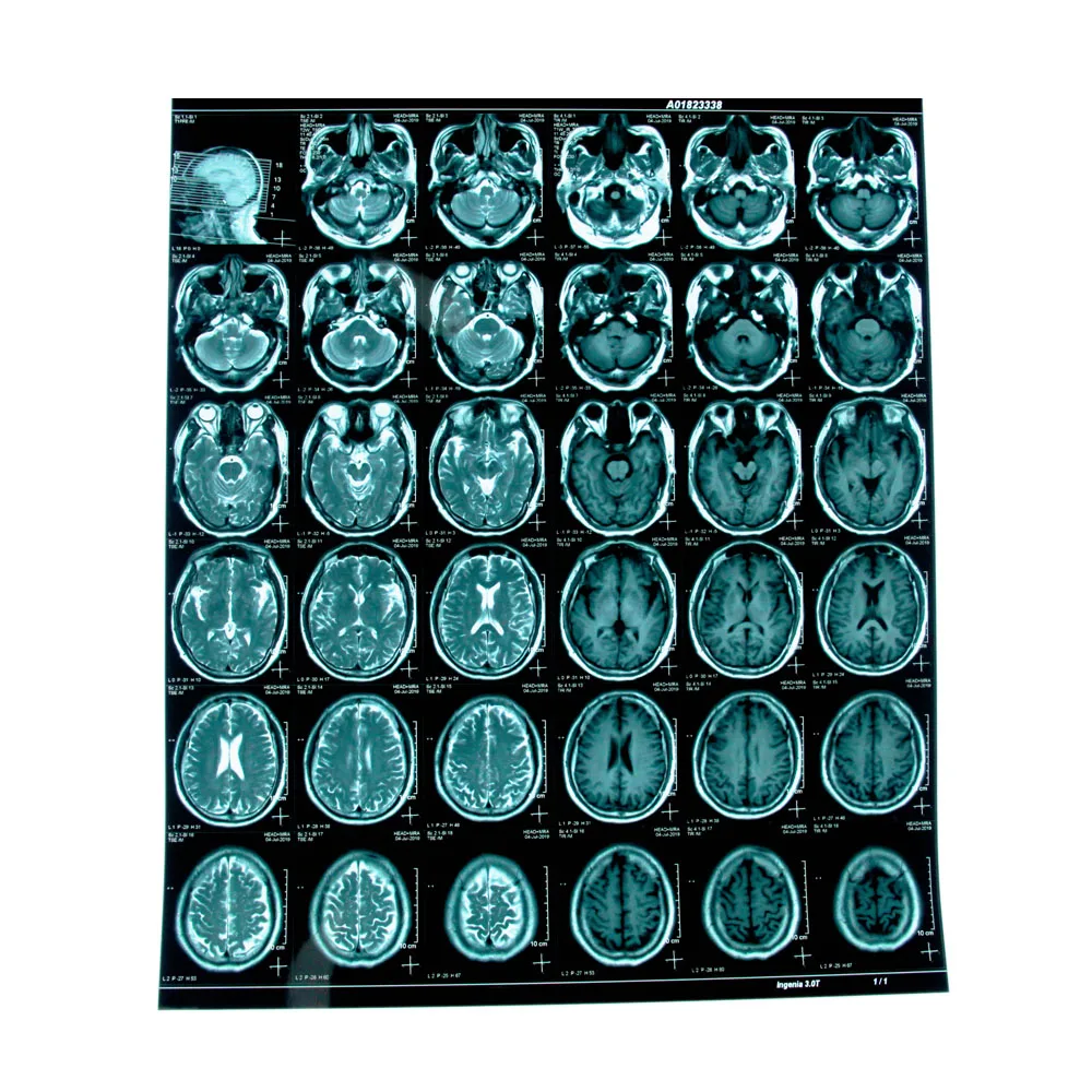 PET base blue sensitive medical dry film for hospital radiography department