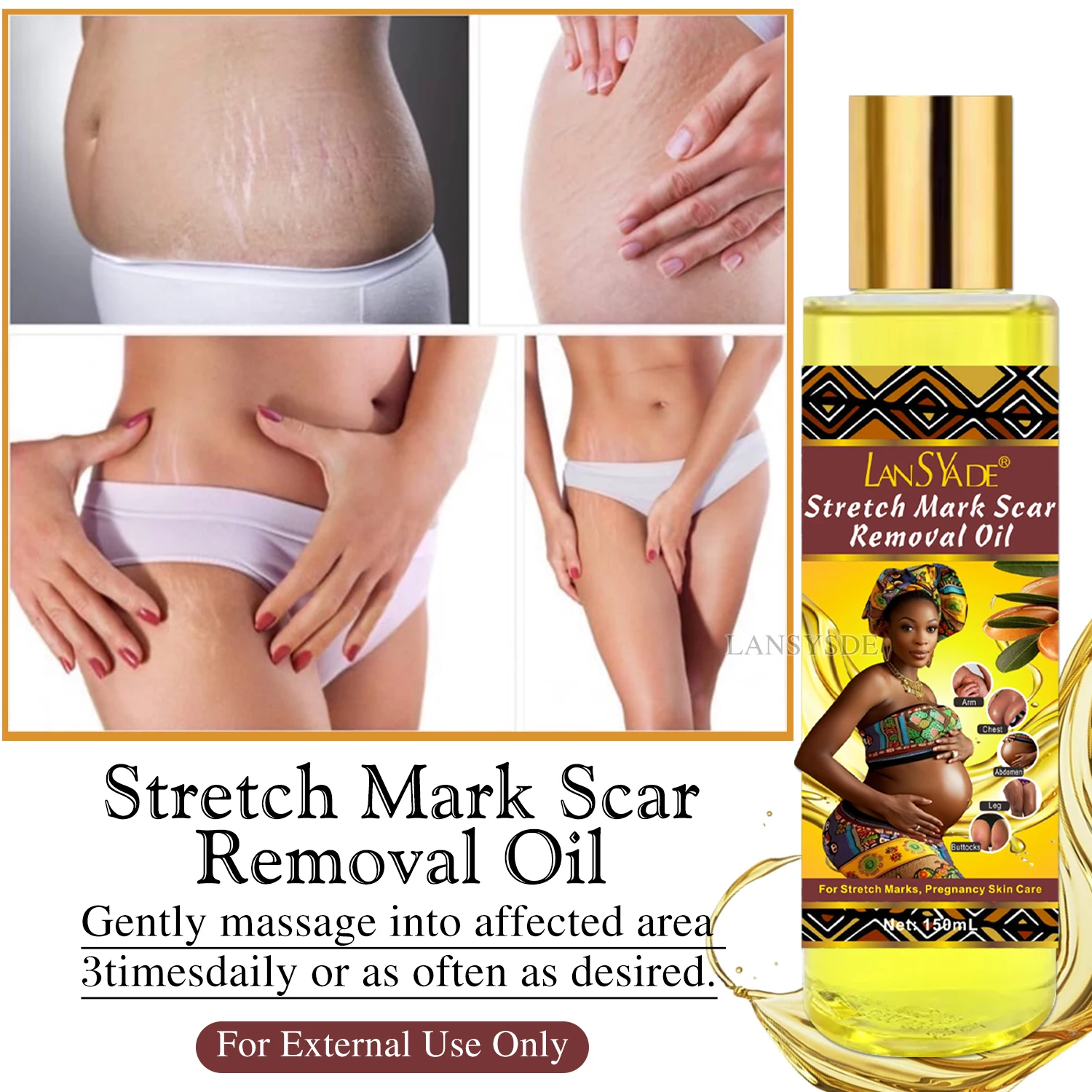 High Quality Pure Stretch Marks Scar Removal Oil Pregnant Scar effective Repair almond oil Stretch Marks Scar Removal Oil