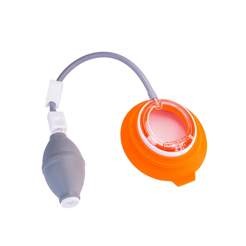 Large size Vacuum Bells for treatment of Pectus Excavatum Sunken Chest