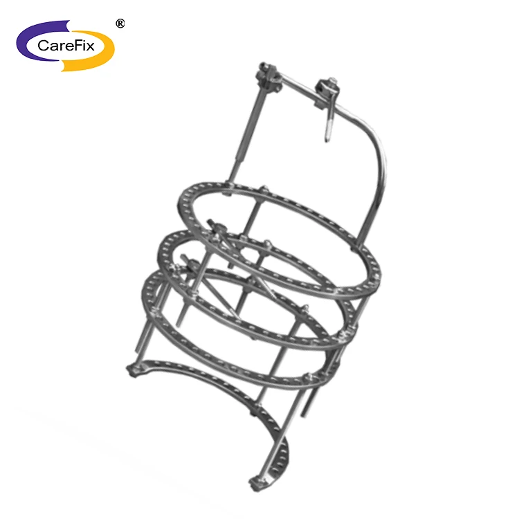 
Orthopedics trauma surgery external fixation bracket fracture internal fixation 