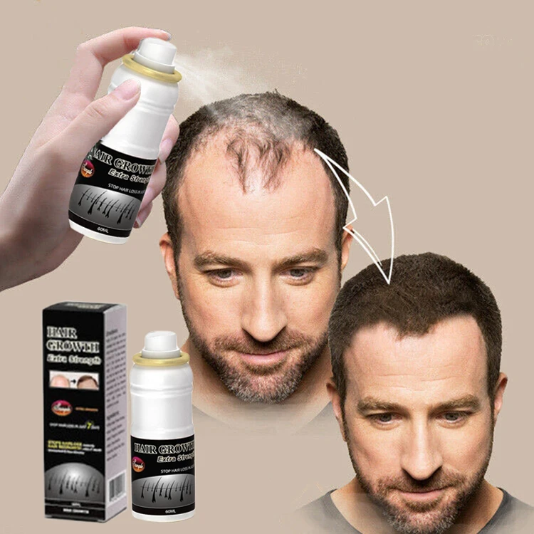 Private Label Hair Loss Treatment Hair Growth Serum Fast Hair Growth Spray