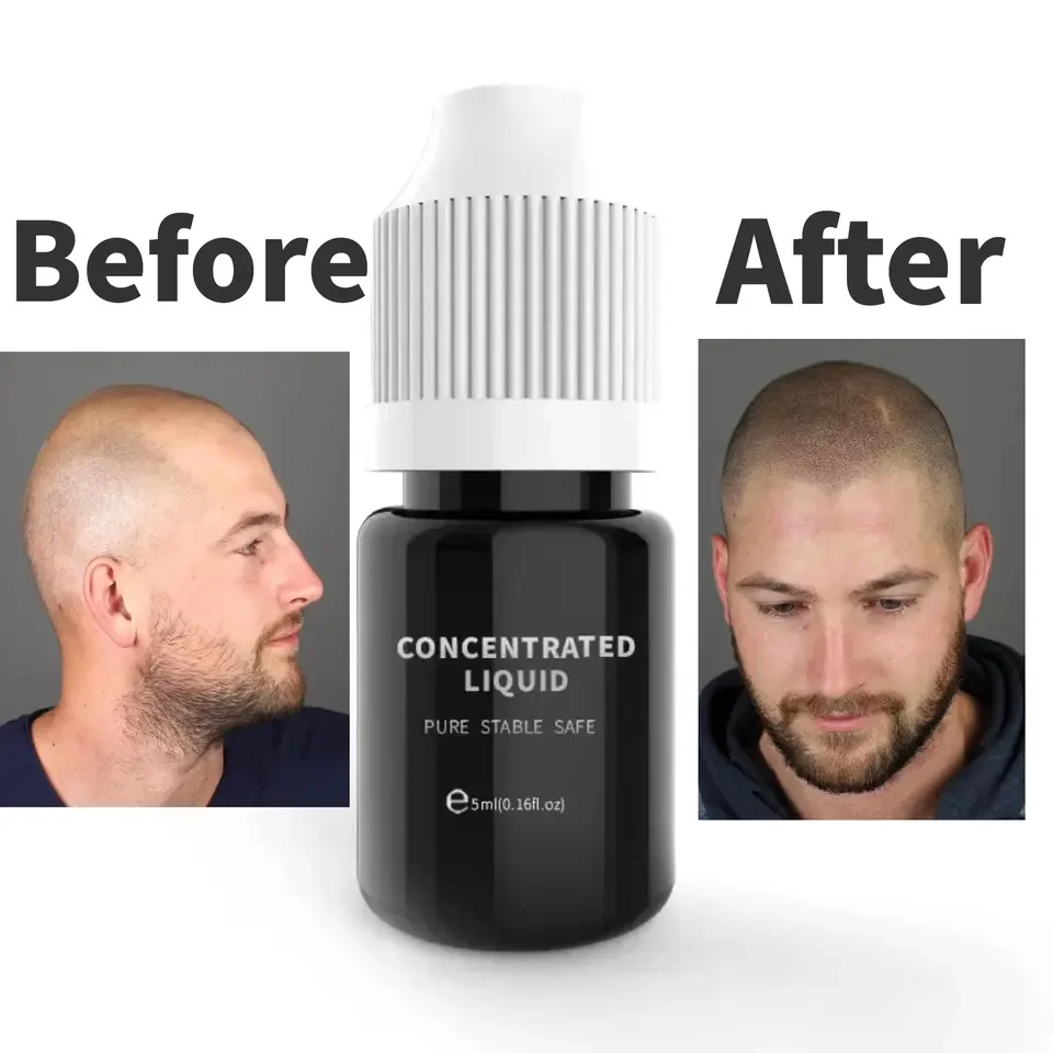 Private labels smp pigments follicle scalp micro tattoo ink hair micropigmentation products OEM microblading pmu organic pigment