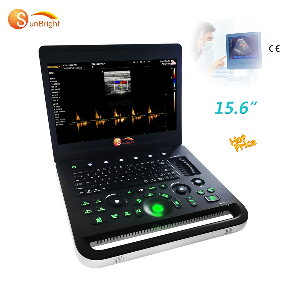 Laptop color ultrasound PW Doppler 3D software large screen display 15.6 inch good price