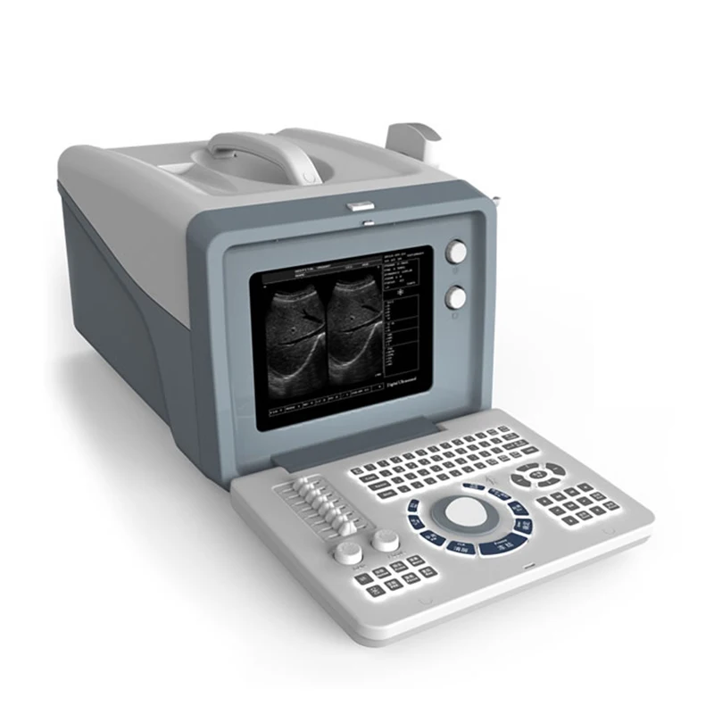 MN-S218 10 Inch CRT Black White Display B Ultrasound Machine  B-type Ultrasonic Diagnostic Instrument Hot Selling