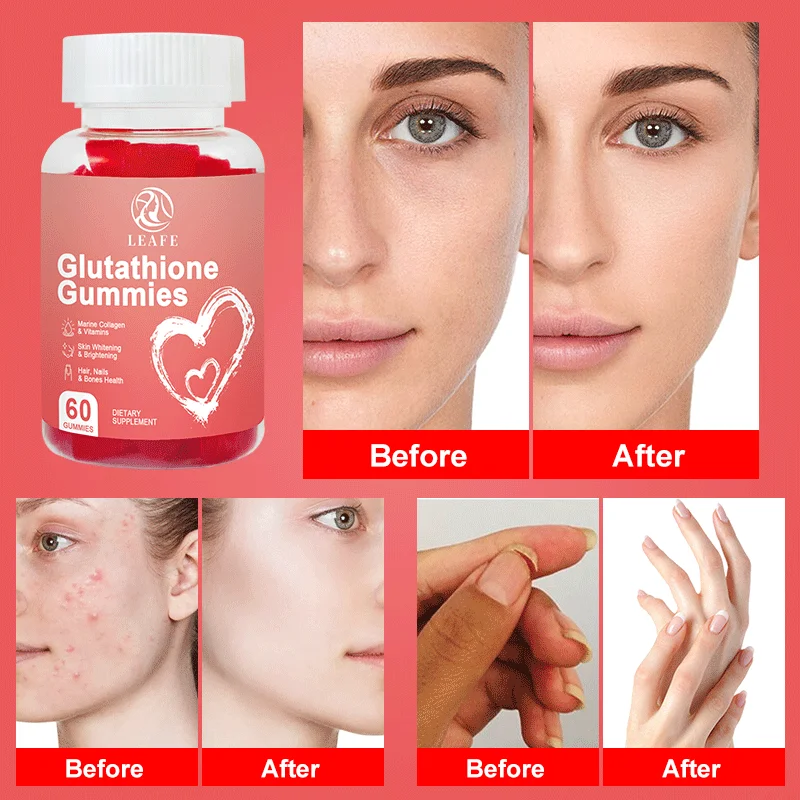 Private Label Glutathione Gummies Collagen Anti-aging L-glutathione Gummies Supplement Brightening Skin Whitening