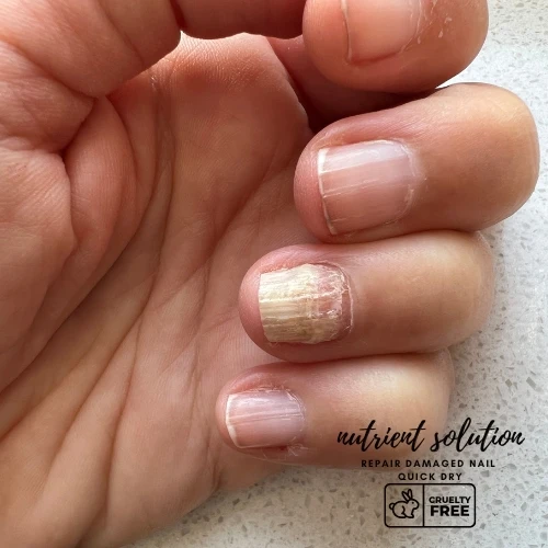 Wholesale Toenail Fungus Nail Treatment Helps Soothe Repair & Stimulate Fresh Clear Nail Growth Serum Private Label