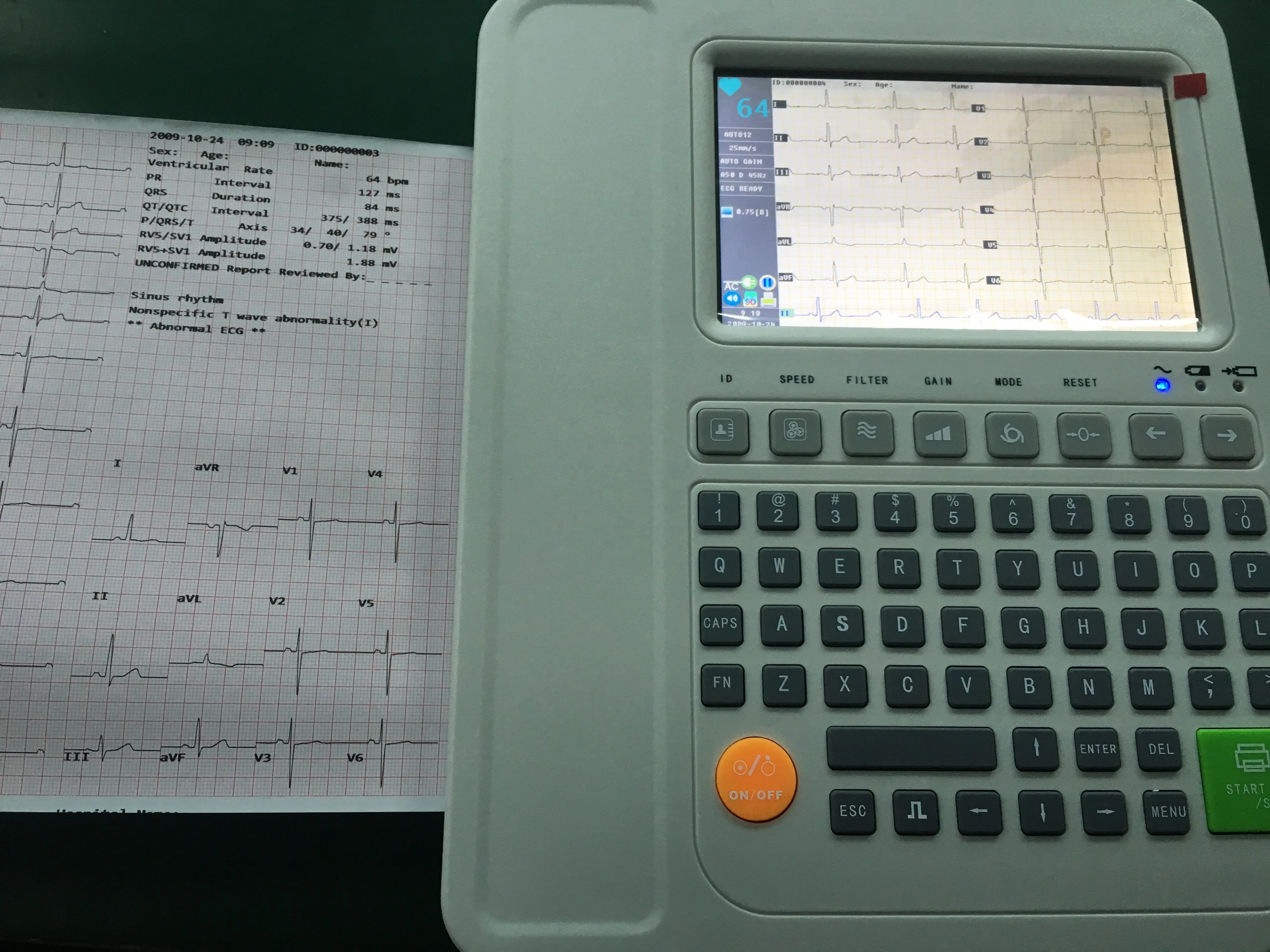 8112 цифровая медицинская машина 12 каналов/выводов ЭКГ/ЭКГ CE ISO