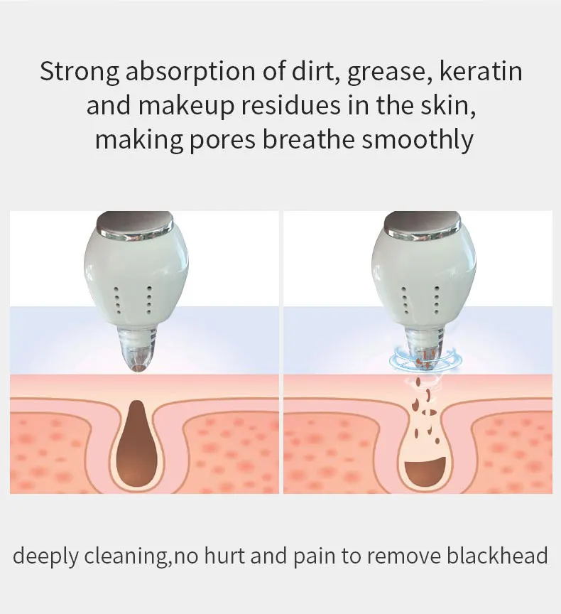 Top Quality Facial Treatment Machine Anti-Puffiness Skin Tightening White Color Blackhead Remover