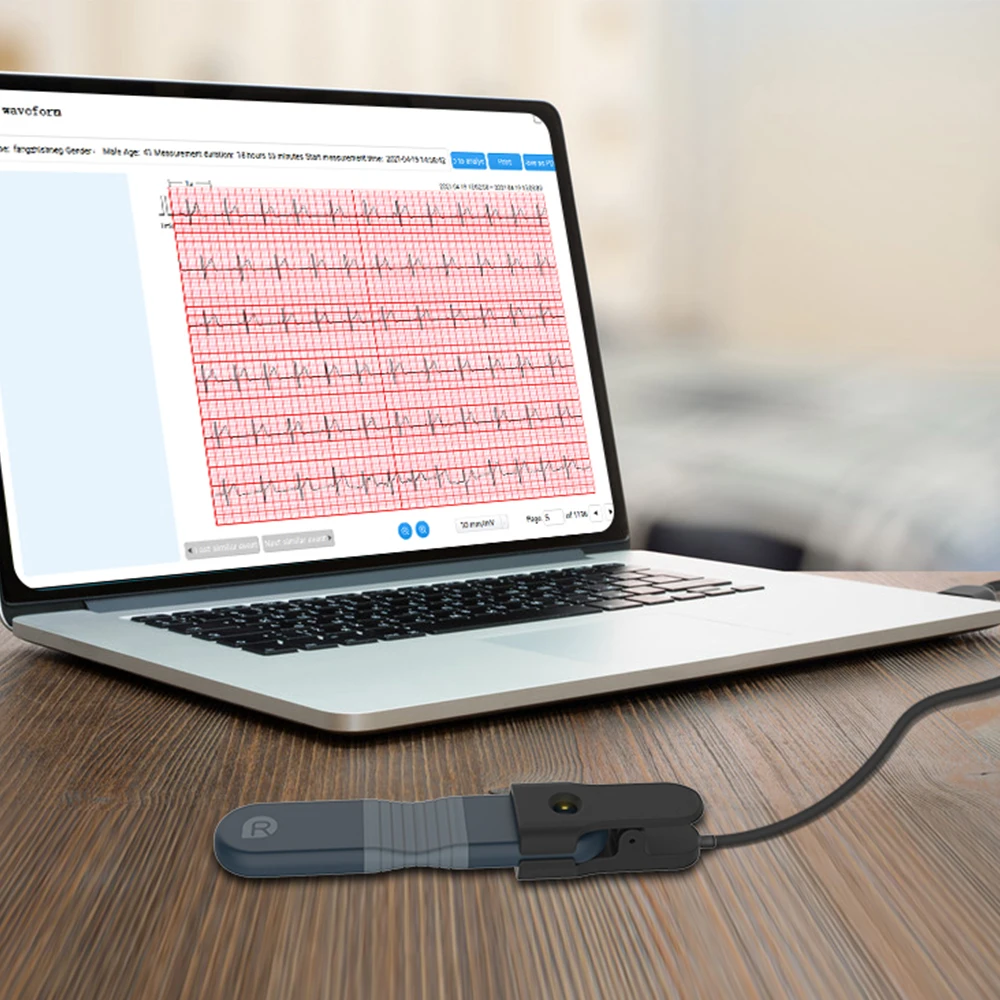 Wellue ER1 Medical Echocardiogram Machine Electrocardiograph Holter Monitor Device Portable Ecg Recorder For Heart Problems