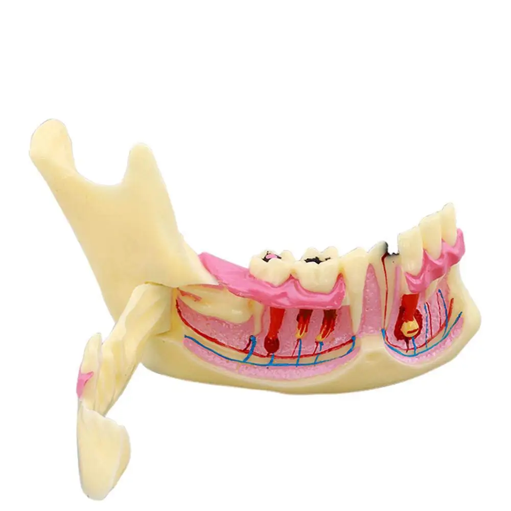 Gelsonlab HSDT-N14 Dental Decomposition Model Organization od Mandible Model