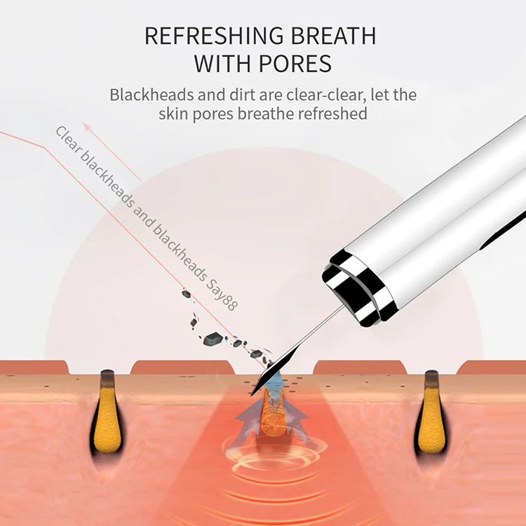 Face Skin Scrubber USB Rechargeable Facial Cleaner Vibration Blackhead Removal Exfoliating Pore Cleaner ultrasonic Skin Scrubber