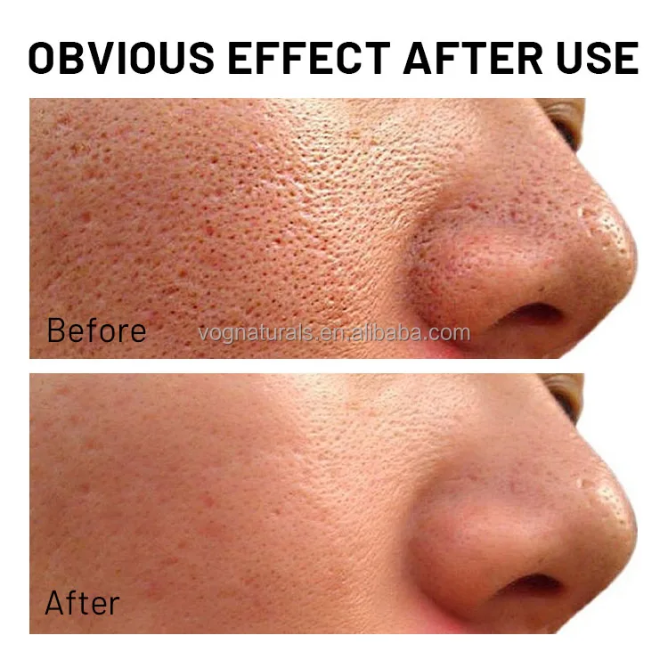 Private Label Chamomile Firming Calendula Cream Refreshing Pores Remover Face Cream Pore Refiner Moisturizer