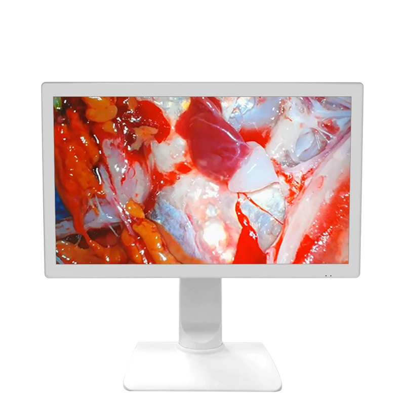 IP54 24 inch 1080P Medical high-definition display screen Endoscope Camera Display Monitor