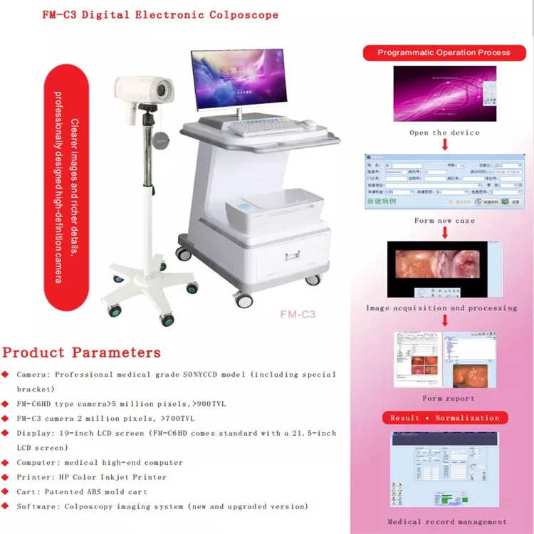 High quality C6HD handheld colposcope medical digital imaging colposcope can be customized