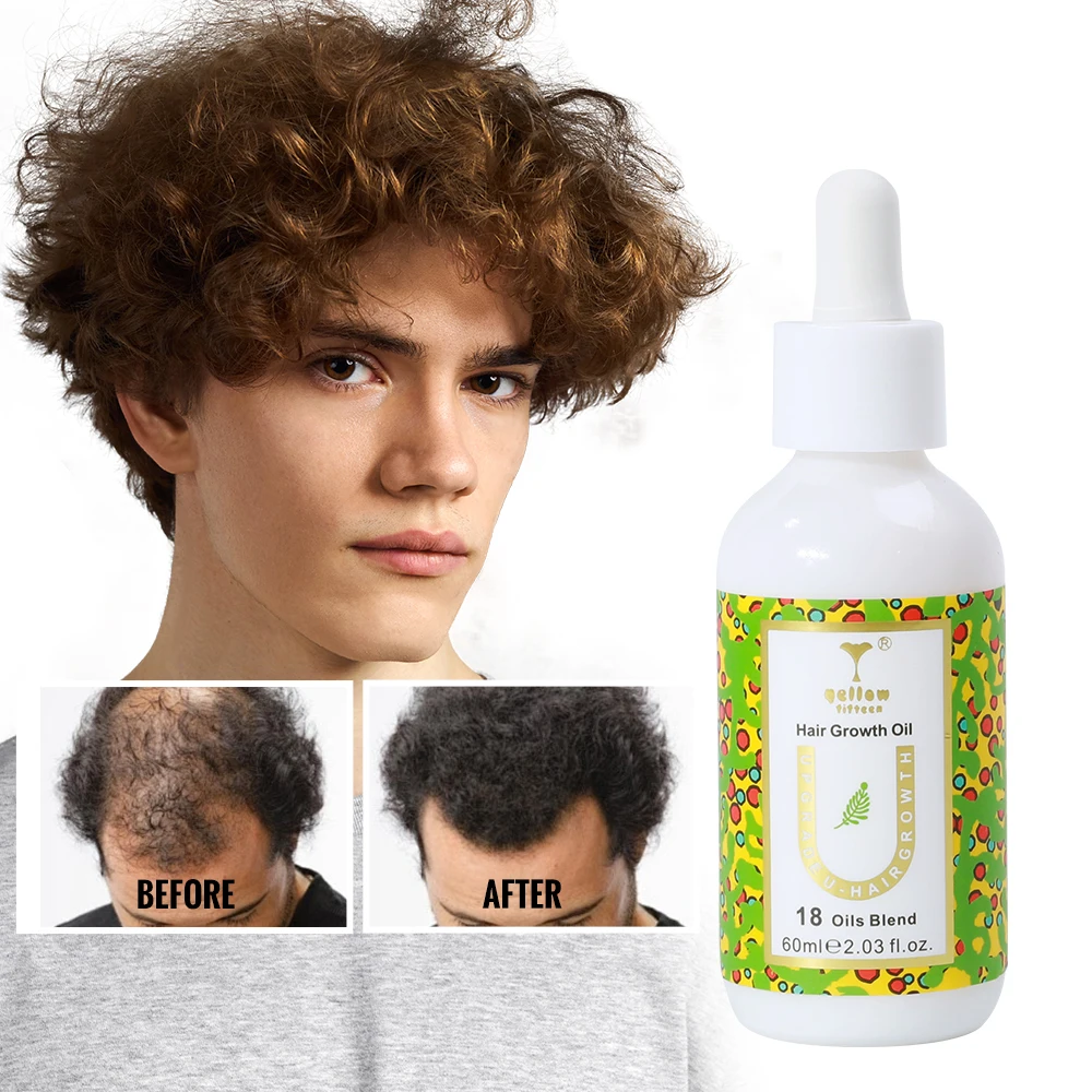 Customization Unlock the Secret to Longer, Thicker Hair with our Nourishing Hair Growth Oil Formula