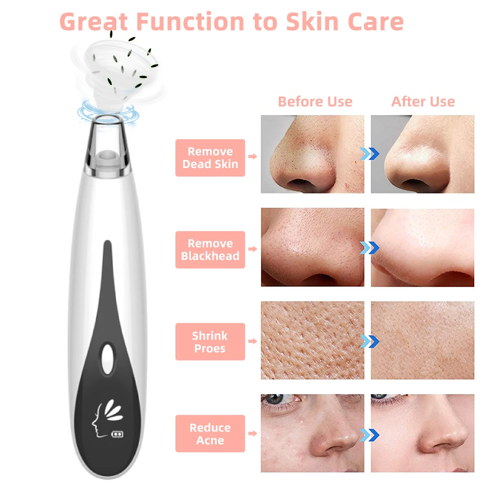 Wholesale Electric Facial Cleaner Come Done Extractor Tool Kit Nose Pore Suction Vacuum Blackhead Remover
