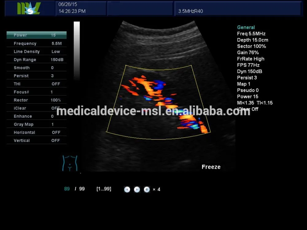 Ультразвуковой аппарат