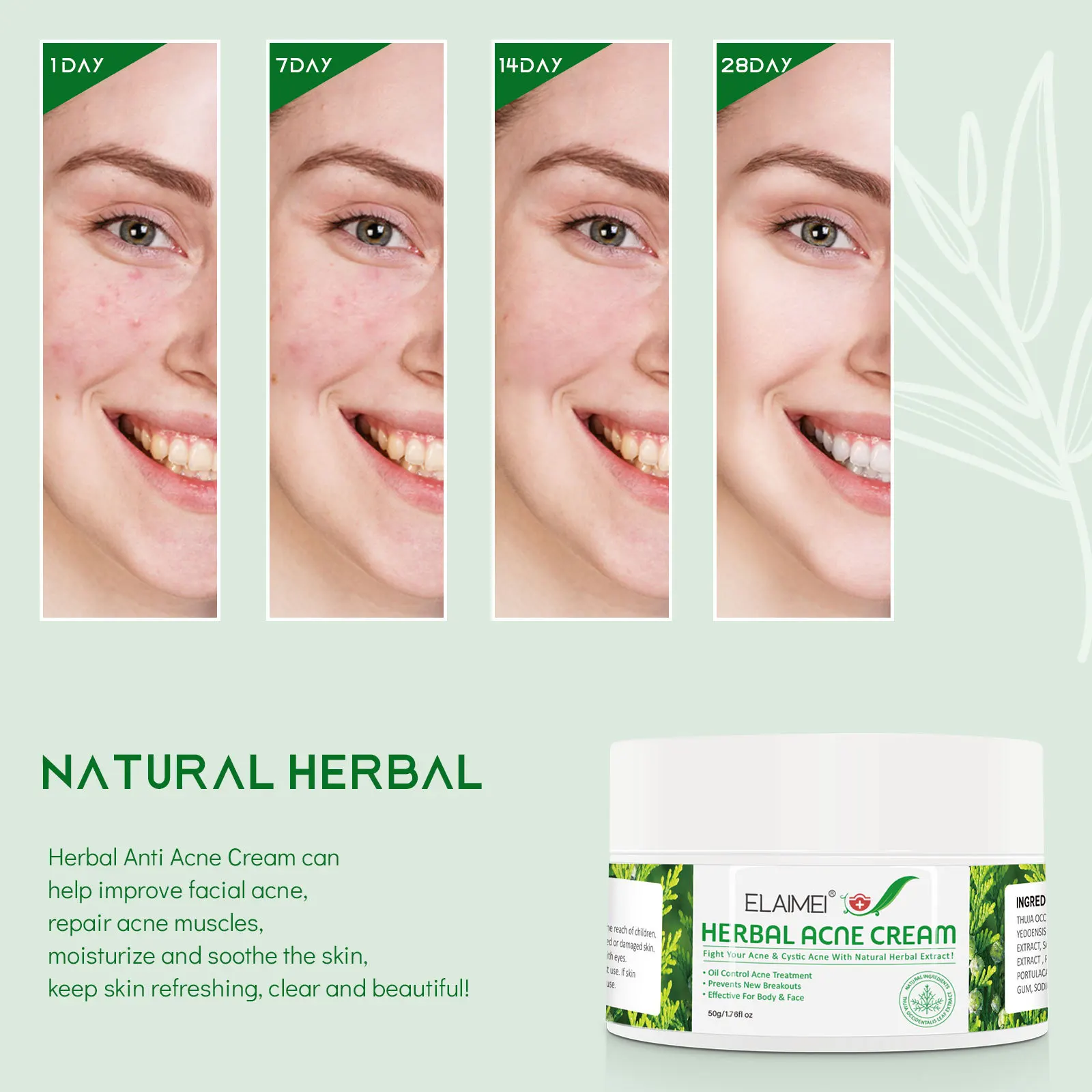 Private Label Natural Herbal Acne Repair Cream Beauty Effective For Face Body Oil Control Acne Treatment Cream